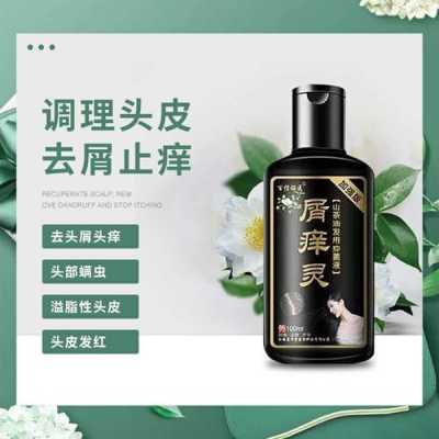 什么能去头屑（什么能去头屑止痒）