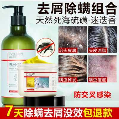 什么能去头屑（什么能去头屑止痒）
