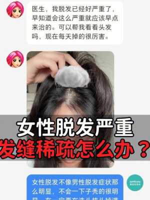 女性掉头发怎么办?吃什么药好,女人头发掉怎么办怎样改善