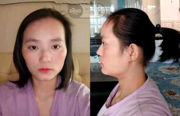 额头怎么胖（什么样的脸型适合把额头露出来）