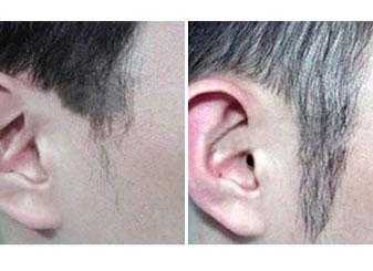 怎么把鬓角变长,鬓角怎么长长的图片