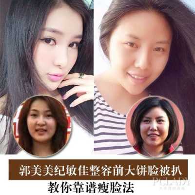大饼脸怎么整容（能让长脸变圆脸吗）