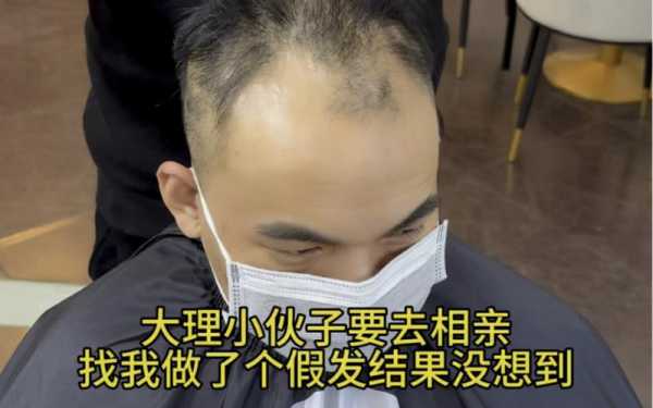 光头带什么假发好（剃光头戴假发怎么样）