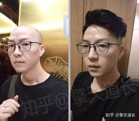光头带什么假发好（剃光头戴假发怎么样）