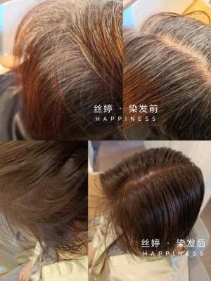 染发怎么盖白发（不染发盖白发最简单的技巧）