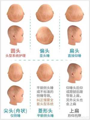 小扁头宝宝适合什么发型,宝宝扁头适合什么发型好看
