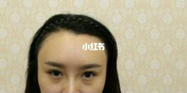 额头多长才算大,脑门宽怎么办才好看
