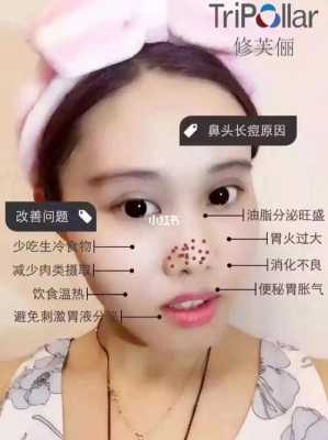 鼻尖长痘怎么消除（鼻尖长痘怎么快速消去）