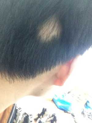 头发变硬怎么回事（为什么头发里有一块变硬）
