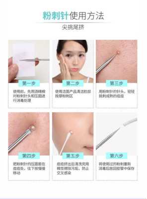 粉刺针怎么用图解（粉刺针怎么用图解黑头）