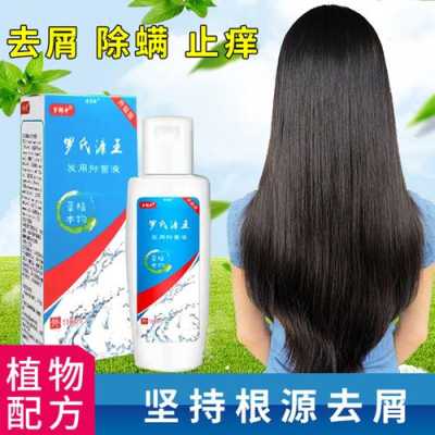 怎样洗头才能去屑止痒,用什么洗头去屑止痒效果好