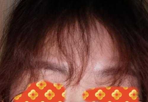 刘海烫坏了怎么办,刘海烫坏了怎么办太卷