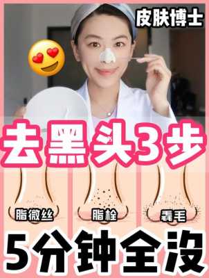 怎么去黑头简单方法（怎么去黑头简单方法图片）