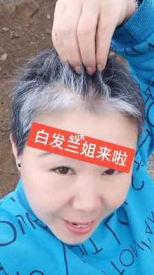 年纪很小出现了很多白头发，怎么办好,有很多白发怎么办女生