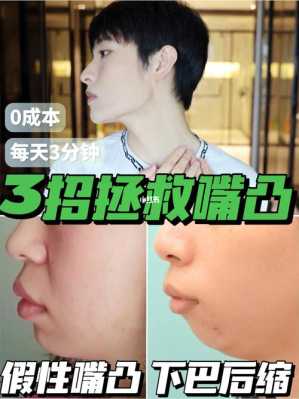 脸凸出来怎么改善,凸形脸怎么办