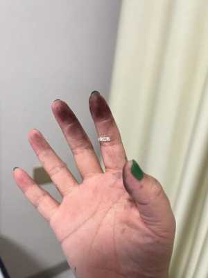 染头发弄到皮肤上怎么洗掉（染头膏弄到手上洗不掉咋办）