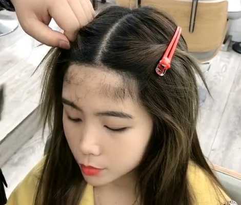 脑门长头发是怎么回事（脑门长头发是怎么回事儿）