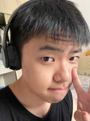 小男孩有抬头纹怎么办,17岁男孩有抬头纹怎么办