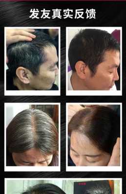 怎么让白头发变成黑头发（怎么让白头发变成黑头发的办法）