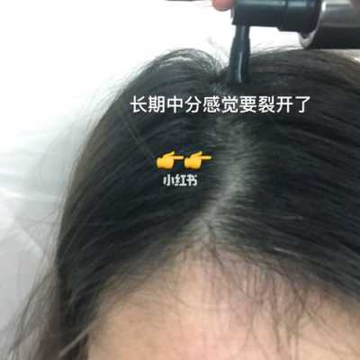 为什么头发越来越少了（头发越来越少了这怎么办）