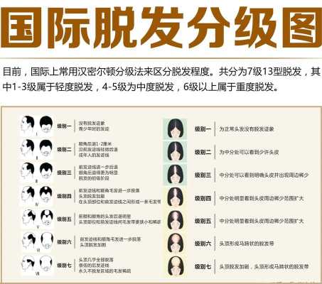 如何分辨人的头发是几度受损发质,怎么辨别脱发还是掉发