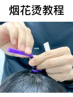 烟花烫伤怎么处理（烟花烫烫坏了怎么补救）
