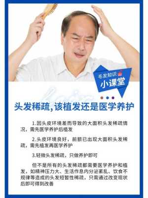 脱发该怎么办,脱发怎么办才好
