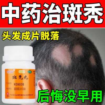 谢顶吃什么药（谢顶吃什么药）