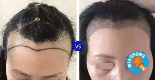 什么叫种头发（什么叫种头发的女人）