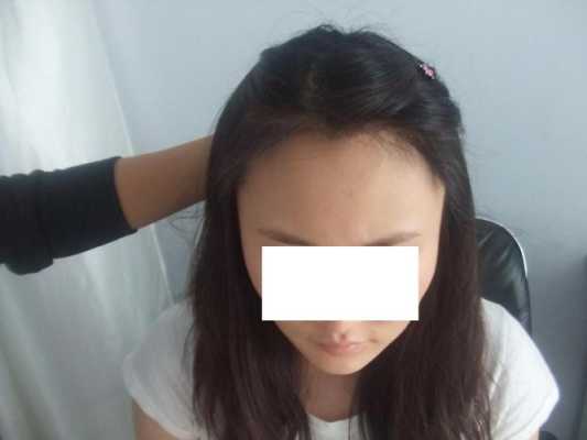 什么叫种头发（什么叫种头发的女人）