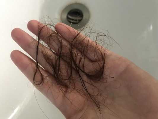 托头发怎么办（托头发是咋回事啊）