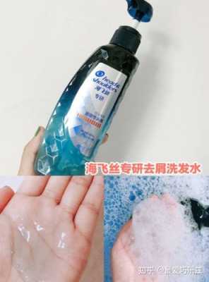 去屑小妙招最快最有效,去头屑有什么妙招吗