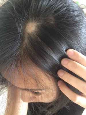 洗头脱发怎么回事（洗头脱发怎么回事女性）