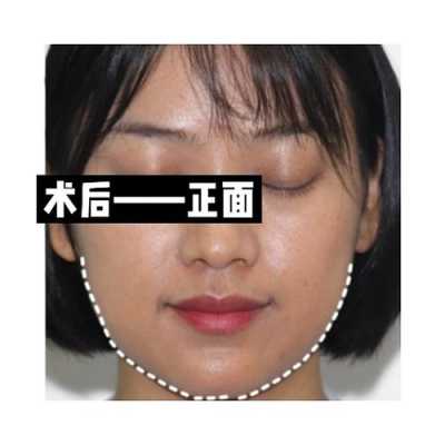 我是一个国字脸如何瘦脸比较好,国字脸怎么变小脸图片