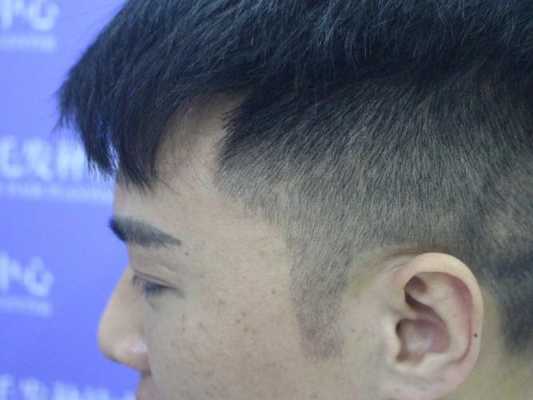 怎么样长鬓角（怎样迅速的让鬓角长长）