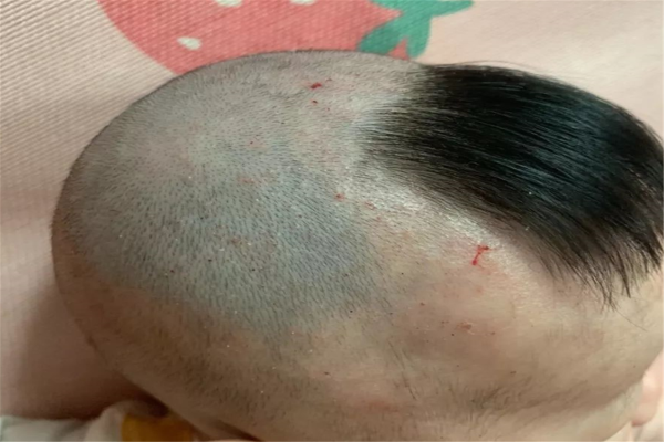 女婴剃什么发型图片（满月剪头发口诀和仪式）