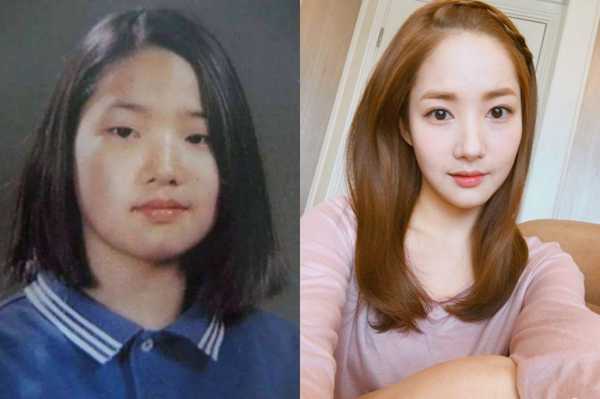 瓜子脸怎么变圆脸,圆脸怎么变鹅蛋脸女生