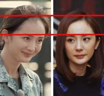 什么是发际线高,什么叫发际线高大全