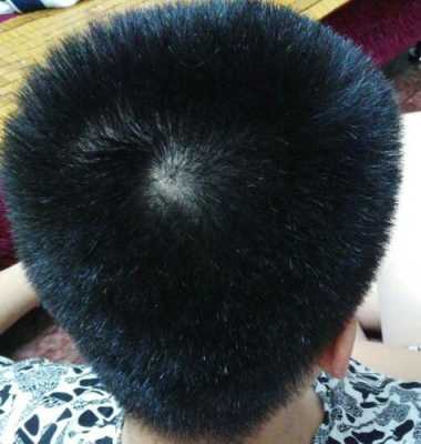 头发硬是好是坏,头发特别硬说明什么原因