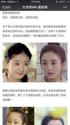 发际线太低怎么办,发际线过低如何调整