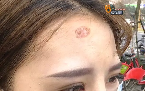 额头的头发怎么弄好看（我额头上有个疤，要怎么做头发才好看呢）