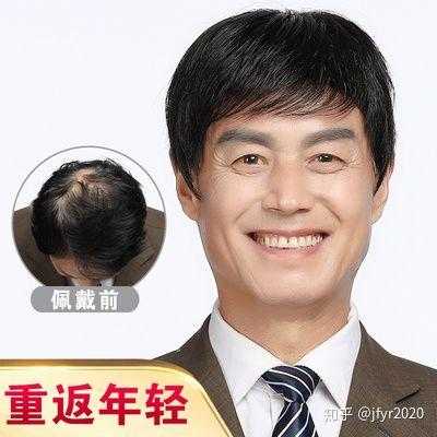 中年人脱发怎么办（55岁以后头发还能生长出来）