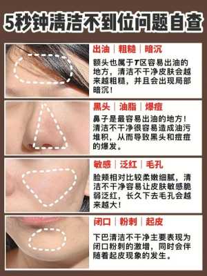 脸上有很多黑头怎么办（如何清理脸上的黑头）