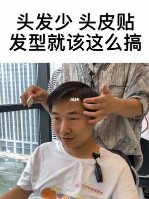 如何让两边的头发贴着头长,头发贴头皮留什么发型男