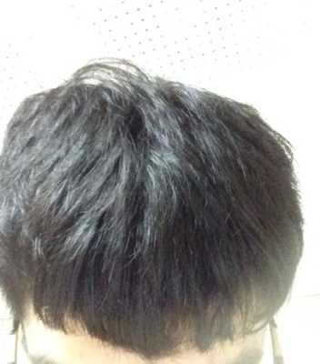 男生头发又干又毛躁怎么办,头发干枯毛躁怎么办男士