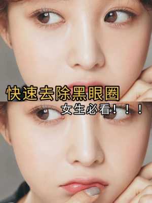 黑眼圈如何快速去除,怎么去黑眼圈简单方法最有效