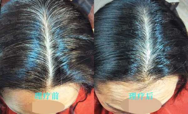 白发为什么会变黑（白发为什么会变黑发）