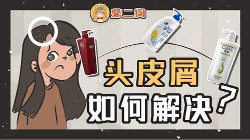 怎么可以去屑（怎么去屑最有效）