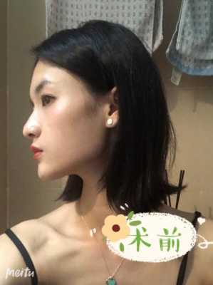本人脸长，下巴较尖，穿什么样的衣服好看?怎样搭配,下巴长怎么整形