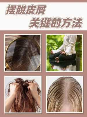 怎么去头皮屑,怎么去头皮削屑